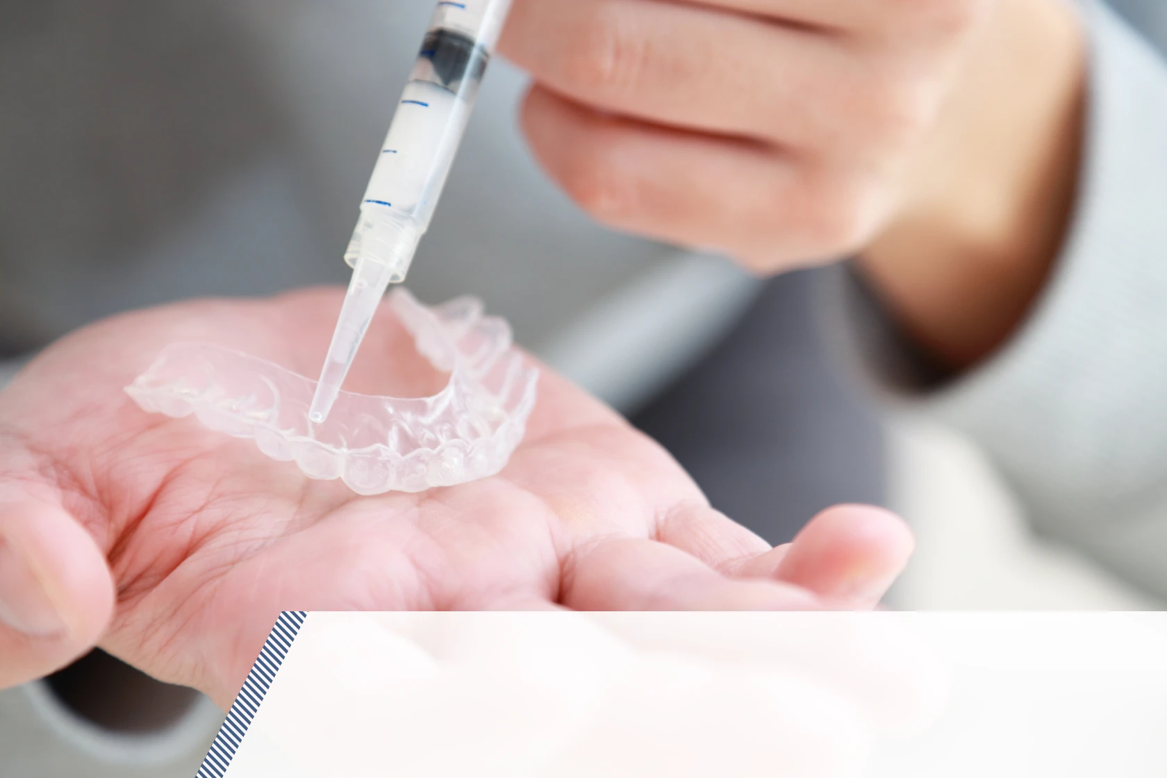 ホワイトニング