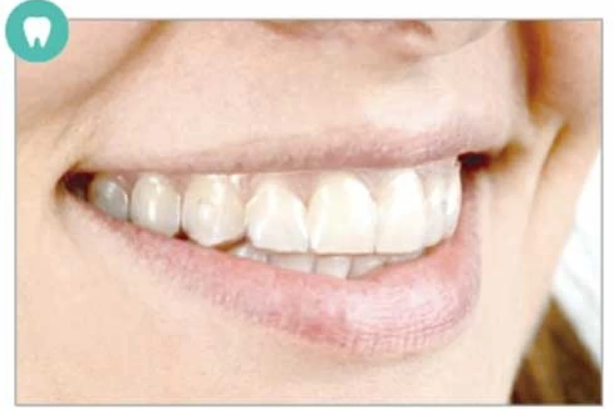 クリアコレクトとは？