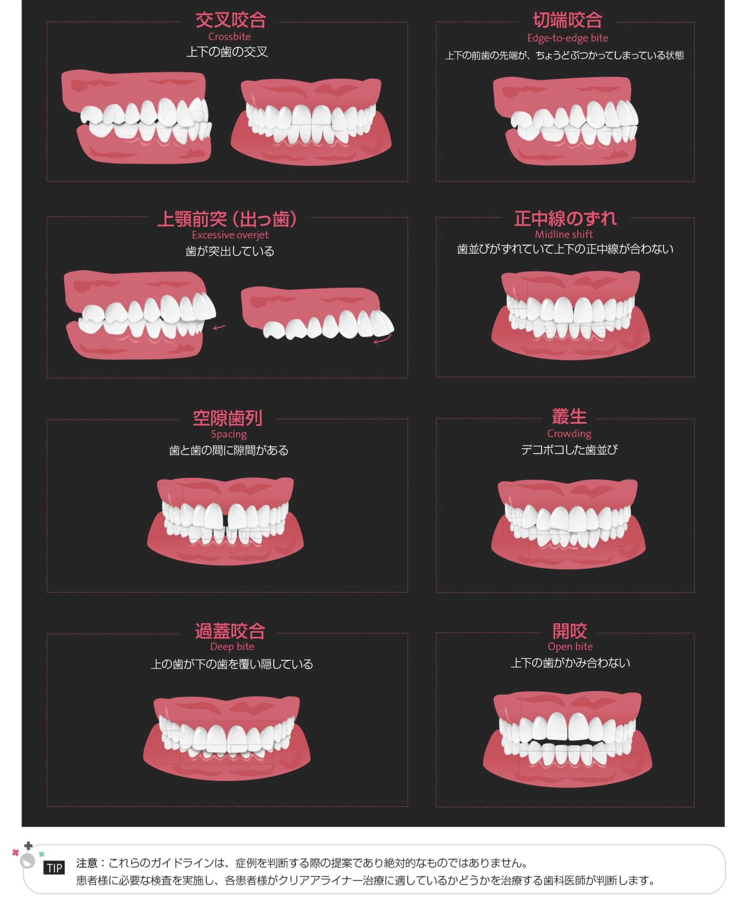 幅広い症例に対応する Clear Correct