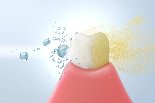 予防歯科を中心に