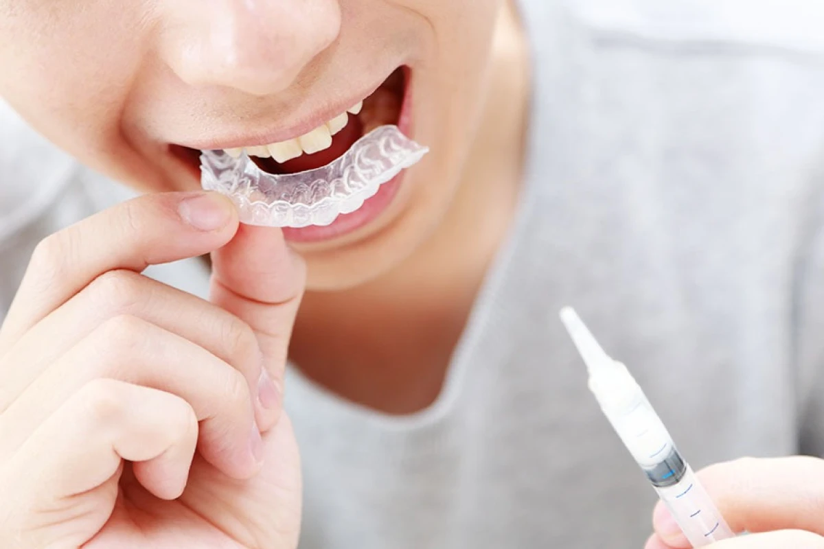 オフィスホワイトニング