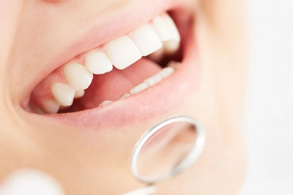 ２週間〜１ヶ月後に経過のチェック