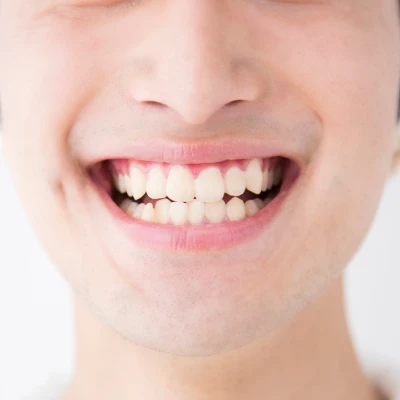 歯・舌・粘膜を守る